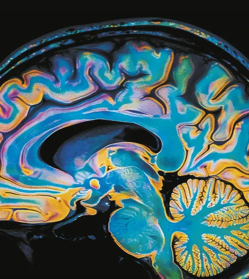 vue de coupe d'un cerveau humain colorisé par l'IA